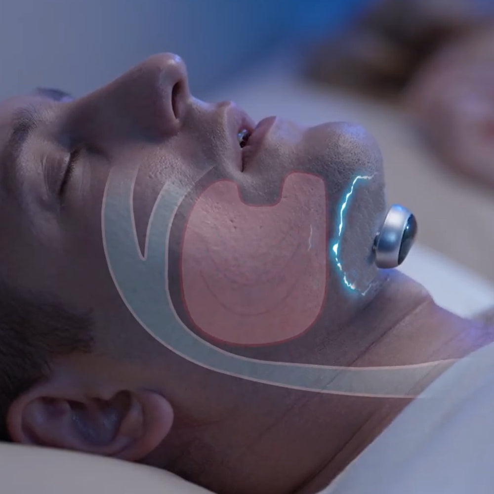 Passo 2 — Selecione a intensidade